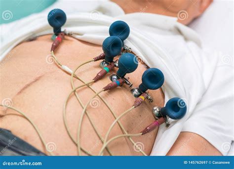 ecg porn|Ecg Porn